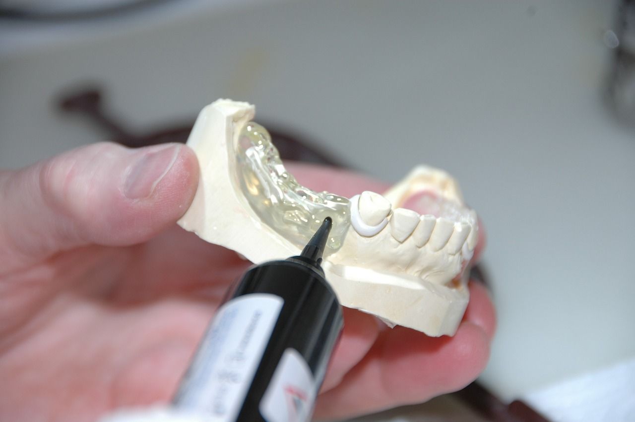 Protetyka stomatologiczna – jedno z rozwiązań na uzupełnienie braków w uzębieniu